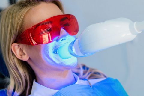 Blanqueamiento dental Sumo Clínica Dental